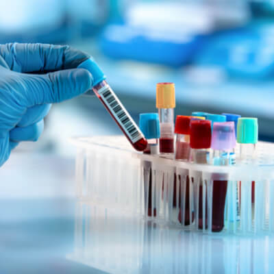 Veteriner Kliniği Laborautar Hizmeti